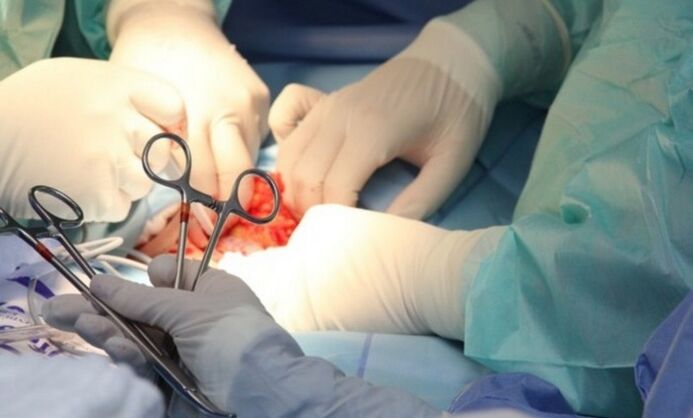 Legamentotomia – intervento chirurgico per l’ingrandimento del pene